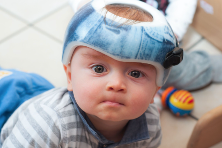 The New Parent Guide to Flat Head Syndrome aka Plagiocephaly